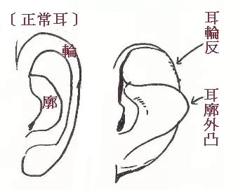 耳骨面相